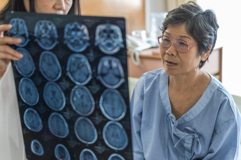Alzheimer's: blood test limits neurological damage