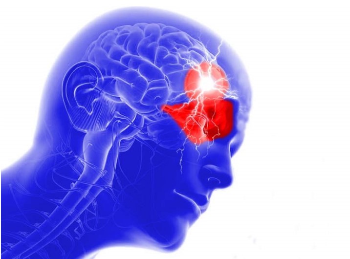 Are people with cluster headaches more likely to suffer from other conditions?
